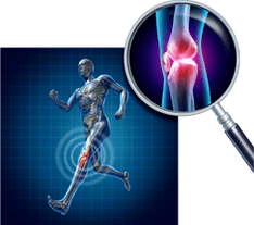 Arthrosis vum Knéi Gelenk